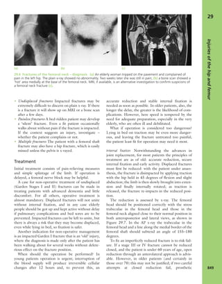 Apley's shoulderjt examination