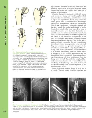 Apley's shoulderjt examination