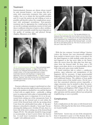 Apley's shoulderjt examination