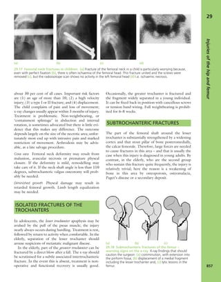 Apley's shoulderjt examination