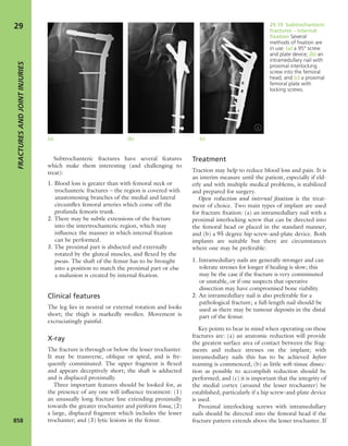 Apley's shoulderjt examination