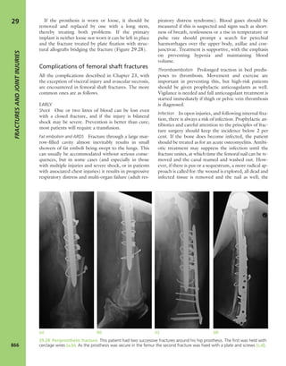 Apley's shoulderjt examination