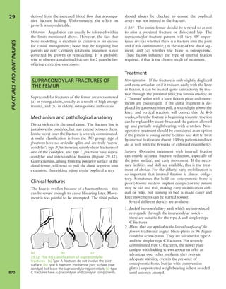 Apley's shoulderjt examination