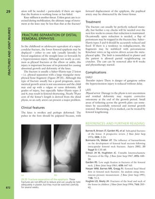 Apley's shoulderjt examination