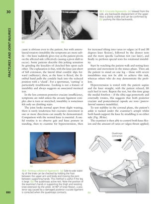 Apley's shoulderjt examination