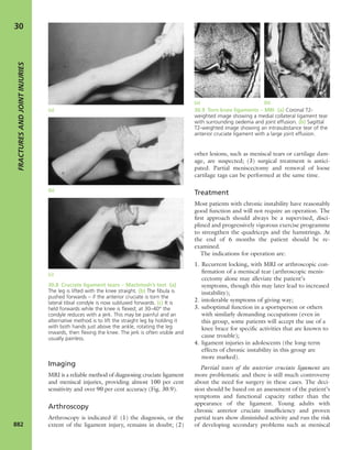 Apley's shoulderjt examination