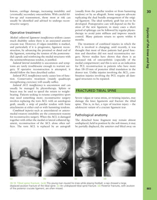 Apley's shoulderjt examination