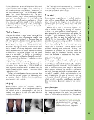 Apley's shoulderjt examination