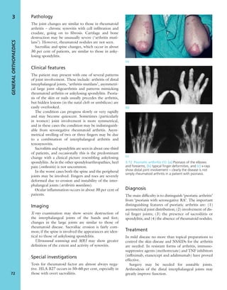Pathology
The joint changes are similar to those in rheumatoid
arthritis – chronic synovitis with cell inﬁltration and
exudate, going on to ﬁbrosis. Cartilage and bone
destruction may be unusually severe (‘arthritis muti-
lans’). However, rheumatoid nodules are not seen.
Sacroiliac and spine changes, which occur in about
30 per cent of patients, are similar to those in anky-
losing spondylitis.
Clinical features
The patient may present with one of several patterns
of joint involvement. These include: arthritis of distal
interphalangeal joints, ‘arthritis mutilans’, asymmetri-
cal large joint oligoarthritis and patterns mimicking
rheumatoid arthritis or ankylosing spondylitis. Psoria-
sis of the skin or nails usually precedes the arthritis,
but hidden lesions (in the natal cleft or umbilicus) are
easily overlooked.
The condition can progress slowly or very rapidly
and may become quiescent. Sometimes (particularly
in women) joint involvement is more symmetrical,
and in these cases the condition may be indistinguish-
able from seronegative rheumatoid arthritis. Asym-
metrical swelling of two or three ﬁngers may be due
to a combination of interphalangeal arthritis and
tenosynovitis.
Sacroiliitis and spondylitis are seen in about one-third
of patients, and occasionally this is the predominant
change with a clinical picture resembling ankylosing
spondylitis. As in the other spondyloarthropathies, heel
pain (enthesitis) is not uncommon.
In the worst cases both the spine and the peripheral
joints may be involved. Fingers and toes are severely
deformed due to erosion and instability of the inter-
phalangeal joints (arthritis mutilans).
Ocular inﬂammation occurs in about 30 per cent of
patients.
Imaging
X-ray examination may show severe destruction of
the interphalangeal joints of the hands and feet;
changes in the large joints are similar to those of
rheumatoid disease. Sacroiliac erosion is fairly com-
mon; if the spine is involved the appearances are iden-
tical to those of ankylosing spondylitis.
Ultrasound scanning and MRI may show greater
deﬁnition of the extent and activity of synovitis.
Special investigations
Tests for rheumatoid factor are almost always nega-
tive. HLA-B27 occurs in 50–60 per cent, especially in
those with overt sacroiliitis.
Diagnosis
The main difﬁculty is to distinguish ‘psoriatic arthritis’
from ‘psoriasis with seronegative RA’. The important
distinguishing features of psoriatic arthritis are: (1)
asymmetrical joint distribution; (2) involvement of dis-
tal ﬁnger joints; (3) the presence of sacroiliitis or
spondylitis; and (4) the absence of rheumatoid nodules.
Treatment
In mild disease no more than topical preparations to
control the skin disease and NSAIDs for the arthritis
are needed. In resistant forms of arthritis, immuno-
suppressive agents (methotrexate) and TNF inhibitors
(inﬂiximab, etanercept and adalimumab) have proved
effective.
Surgery may be needed for unstable joints.
Arthrodesis of the distal interphalangeal joints may
greatly improve function.
GENERALORTHOPAEDICS
72
3
(a)
(b)
(c)
3.12 Psoriatic arthritis (1) (a) Psoriasis of the elbows
and forearms; (b) typical ﬁnger deformities, and (c) x-rays
show distal joint involvement – clearly the disease is not
simply rheumatoid arthritis in a patient with psoriasis.
 