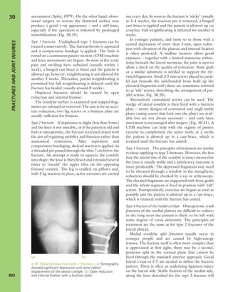 Apley's shoulderjt examination