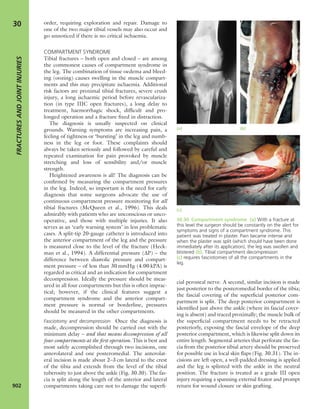 Apley's shoulderjt examination