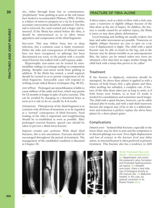 Apley's shoulderjt examination