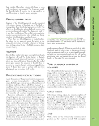 Apley's shoulderjt examination