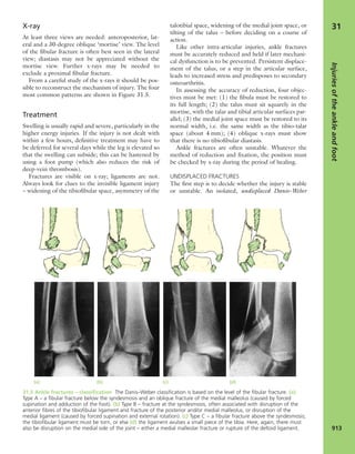 Apley's shoulderjt examination
