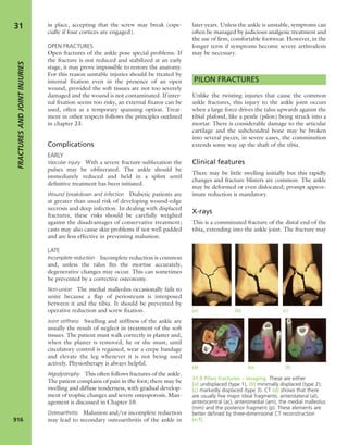 Apley's shoulderjt examination