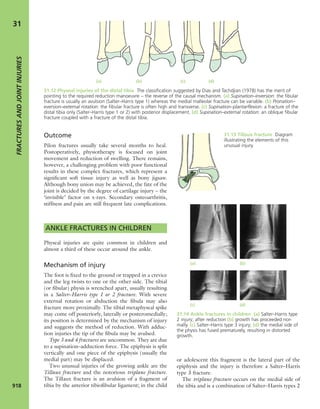 Apley's shoulderjt examination