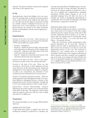 Apley's shoulderjt examination