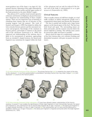 Apley's shoulderjt examination