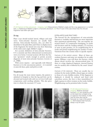 Apley's shoulderjt examination