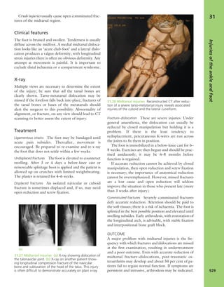 Apley's shoulderjt examination