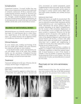 Apley's shoulderjt examination