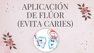 APLICACIÓN
DE FLÚOR
(EVITA CARIES)
 