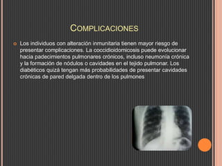 COMPLICACIONES
 Los individuos con alteración inmunitaria tienen mayor riesgo de
presentar complicaciones. La coccidioidomicosis puede evolucionar
hacia padecimientos pulmonares crónicos, incluso neumonía crónica
y la formación de nódulos o cavidades en el tejido pulmonar. Los
diabéticos quizá tengan más probabilidades de presentar cavidades
crónicas de pared delgada dentro de los pulmones
 