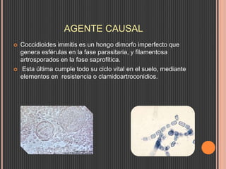 AGENTE CAUSAL
 Coccidioides immitis es un hongo dimorfo imperfecto que
genera esférulas en la fase parasitaria, y filamentosa
artrosporados en la fase saprofítica.
 Esta última cumple todo su ciclo vital en el suelo, mediante
elementos en resistencia o clamidoartroconidios.
 