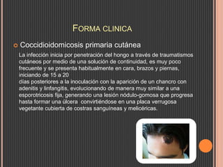 FORMA CLINICA
 Coccidioidomicosis primaria cutánea
La infección inicia por penetración del hongo a través de traumatismos
cutáneos por medio de una solución de continuidad, es muy poco
frecuente y se presenta habitualmente en cara, brazos y piernas,
iniciando de 15 a 20
días posteriores a la inoculación con la aparición de un chancro con
adenitis y linfangitis, evolucionando de manera muy similar a una
esporotricosis fija, generando una lesión nódulo-gomosa que progresa
hasta formar una úlcera convirtiéndose en una placa verrugosa
vegetante cubierta de costras sanguíneas y melicéricas.
 