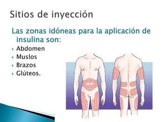 Las zonas idóneas para la aplicación de
insulina son:
 Abdomen
 Muslos
 Brazos
 Glúteos.
 
