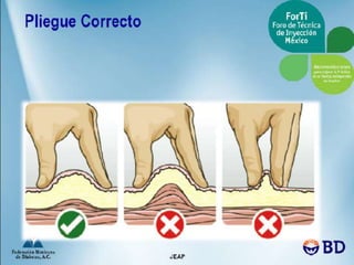 Aplicacion de insulinas