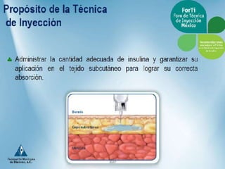 Aplicacion de insulinas