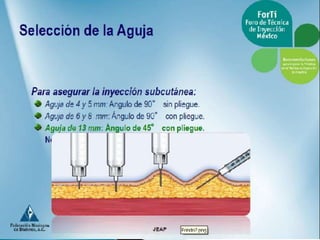 Aplicacion de insulinas