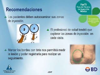 Aplicacion de insulinas