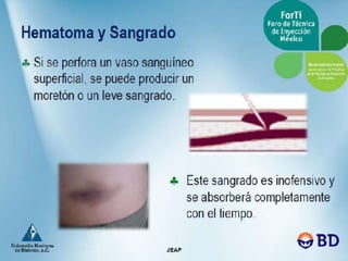 Aplicacion de insulinas