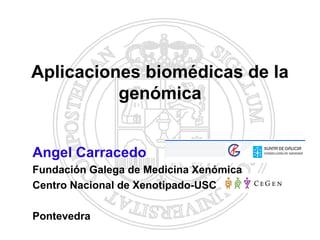 Aplicaciones biomédicas de la
          genómica


Angel Carracedo
Fundación Galega de Medicina Xenómica
Centro Nacional de Xenotipado-USC

Pontevedra
 