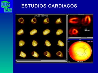 ESTUDIOS CARDIACOS 