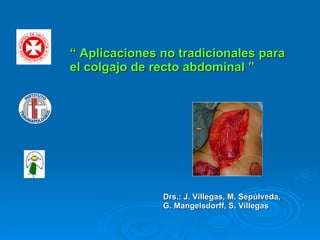   “  Aplicaciones no tradicionales para el colgajo de recto abdominal ” Drs.: J. Villegas, M. Sepúlveda, G. Mangelsdorff, S. Villegas 
