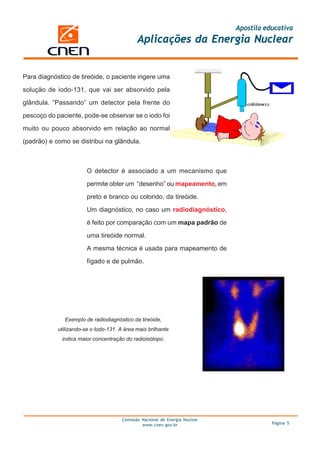 Apostila educativa
                                              Aplicações da Energia Nuclear


Para diagnóstico de tireóide, o paciente ingere uma

solução de iodo-131, que vai ser absorvido pela

glândula. “Passando” um detector pela frente do

pescoço do paciente, pode-se observar se o iodo foi

muito ou pouco absorvido em relação ao normal

(padrão) e como se distribui na glândula.



                        O detector é associado a um mecanismo que
                        permite obter um “desenho” ou mapeamento, em

                        preto e branco ou colorido, da tireóide.

                        Um diagnóstico, no caso um radiodiagnóstico,

                        é feito por comparação com um mapa padrão de

                        uma tireóide normal.

                        A mesma técnica é usada para mapeamento de

                        fígado e de pulmão.




              Exemplo de radiodiagnóstico da tireóide,
            utilizando-se o Iodo-131. A área mais brilhante
             indica maior concentração do radioisótopo.




                                       Comissão Nacional de Energia Nuclear
                                                www.cnen.gov.br                          Página 5
 