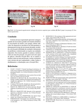 Situações em que a Técnica do Arco Segmentado deve Ser Priorizada em Relação a Arcos Contínuos                     65




     Esta figura não está boa.
                                                                                                  Esta figura não está boa.
     Com baixa resolução
                                                                                                  Com baixa resolução
     Favor enviar novo arquivo
                                                                                                  Favor enviar novo arquivo




Fig. 9A                                         Fig. 9B                                        Fig. 9C


Fig. 9 A-C – A. Vista lateral esquerda inicial: inclinação dos incisivos superiores para vestibular; B. Mola T grupo A em posição; C. Vista
lateral esquerda final.


                                                                        9.    BUrsToNe CJ. The mechanics of the segmented arch tech-
Conclusão                                                                     niques. Angle Orthod 1966; 36:99-120.
                                                                        10.   HoCevar ra. Understanding, planning, and managing tooth
    A técnica do arco segmentado apresenta vantagens                          movement: orthodontic force system theory. Am J Orthod
quando são necessários grandes movimentos dentários                           1981; 80:457-477.
ou movimentos de dentes com grande volume radi-                         11.   liNDaUer sJ. The Basics of orthodontic mechanics. Semi-
cular. Os dispositivos mecânicos da TAS permitem o                            nars in Orthodontics 2001:2-15.
                                                                        12.   smiTH rJ, BUrsToNe CJ. mechanics of tooth movement.
planejamento do tipo de movimento desejado, incidin-                          Am J Orthod 1984; 85:294-307.
do, com boa previsibilidade de resultados, diretamente                  13.   TaNNe kk, H.a.; BUrsToNe, CJ. moment to force ratio and
no problema e minimizando as reações nas unidades                             center of rotation. Am J Orthod Dent Orthop 1988; 94:426-431.
adjacentes. Em resumo, quando os caninos e molares                      14.   iNgervall Bg, P.; geBaUer, U. a clinical investigation
                                                                              of the correction of first molar crossbite with a transpalatal
estão em uma boa posição, em geral você será capaz                            arch. Am J Orthod Dent Orthop 1995: 418-425.
de aplicar a filosofia Straight Wire. Se os caninos e                   15.   kUHlBerg aJ. Cantiléver springs: Force system and Clini-
molares estão em uma má posição, corrija-os primeiro                          cal applications. Seminars in Orthodontics 2001:150-159.
com a técnica do arco segmentado e, então, realize o                    16.   melseN B, BoNeTTi g, giUNTa D. statically determinate
                                                                              transpalatal arches. J Clin Orthod 1994; 28:602-606.
detalhamento e a finalização com o Straight Wire.                       17.   alTmaN Ja, arNolD H, sPeCTor P. substituting
                                                                              maxillary first premolars for maxillary impacted canines in
Referências                                                                   cases requiring the extraction of dental units as part of orth-
                                                                              odontic correction. Am J Orthod 1979; 75:618-629.
1.    UgUr T, YUkaY F. Normal faciolingual inclinations of              18.   sakima mT. maringá, v.5, n.2, p.91-115, mar-abr. 2000.
      tooth crowns compared with treatment groups of standard and             Técnica do arco segmentado de Burstone. r Dental Press
      pretorqued brackets. Am J Orthod Dentofacial Orthop 1997;               ortodon ortop Facial 2000; 5:91-115.
      112:50-57.                                                        19.   PaTel s, CaCCiaFesTa v, BosCH C. alignment of im-
2.    BUrsToNe CJ, koeNig Ha. Force systems from an ideal                     pacted canines with cantiléveres and box loops. J Clin Orthod
      arch. Am J Orthod 1974; 65:270-289.                                     1999; 33:82-85.
3.    germaNe N, BeNTleY Be, Jr., isaaCsoN rJ. Three                    20.   marCoTTe mr. The mechanical plan of the segmented arch
      biologic variables modifying faciolingual tooth angulation by           technique. Semin Orthod 2001; 7:191-206.
      straight-wire appliances. Am J Orthod Dentofacial Orthop          21.   WeilaND FJ, BaNTleoN HP, DrosCHl H. evaluation
      1989; 96:312-319.                                                       of continuous arch and segmented arch leveling techniques
4.    Creekmore TD, kunik rl. straight wire: the next generation.             in adult patients–a clinical study. Am J Orthod Dentofacial
      Am J Orthod Dentofacial Orthop 1993; 104:8-20.                          Orthop 1996; 110:647-652.
5.    sCHaUs Jg, Nikolai rJ. Localized, transverse, flexural            22.   sHroFF B, liNDaUer sJ, BUrsToNe CJ, leiss JB.
      stiffnesses of continuous arch wires. Am J Orthod 1986; 89:407-         segmented approach to simultaneous intrusion and space
      414.                                                                    closure: biomechanics of the three-piece base arch appliance.
6.    BraUN s, marCoTTe mr. rationale of the segmented                        Am J Orthod Dentofacial Orthop 1995; 107:136-143.
      approach to orthodontic treatment. Am J Orthod Dentofac           23.   WeilaND FJ, BaNTleoN HP, DrosCHl H. molar up-
      Orthop 1995; 108:1-8.                                                   righting with crossed tipback springs. J Clin Orthod 1992;
7.    isaaCsoN rJl, s.J.; rUBeNsTeiN, lk. incisor torque                      26:335-337.
      control. Am J Orthod Dent Orthop 1993: 428-438.                   24.   melseN B, Fiorelli g, BergamiNi a. Uprighting of
8.    ParkHoUse rC. rectangular wire and third-order torque:                  lower molars. J Clin Orthod 1996; 30:640-645.
      a new perspective. Am J Orthod Dentofacial Orthop 1998;           25.   marCoTTe mr. Biomecânica em ortodontia. são Paulo:
      113:421-430.                                                            ed. santos; 2003.
 