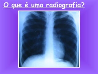 O que é uma radiografia?
 