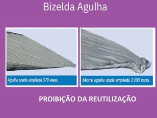 PROIBIÇÃO DA REUTILIZAÇÃO
Bizelda Agulha
 