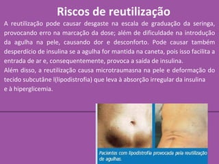 Riscos de reutilização
A reutilização pode causar desgaste na escala de graduação da seringa,
provocando erro na marcação da dose; além de dificuldade na introdução
da agulha na pele, causando dor e desconforto. Pode causar também
desperdício de insulina se a agulha for mantida na caneta, pois isso facilita a
entrada de ar e, consequentemente, provoca a saída de insulina.
Além disso, a reutilização causa microtraumasna na pele e deformação do
tecido subcutâne l(lipodistrofia) que leva à absorção irregular da insulina
e à hiperglicemia.
 
