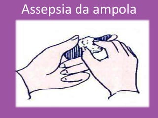 Assepsia da ampola
 