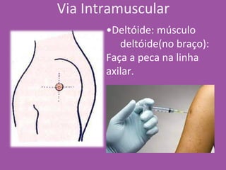 •Deltóide: músculo
deltóide(no braço):
Faça a peca na linha
axilar.
Via Intramuscular
 