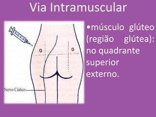 Via Intramuscular
•músculo glúteo
(região glútea):
no quadrante
superior
externo.
 
