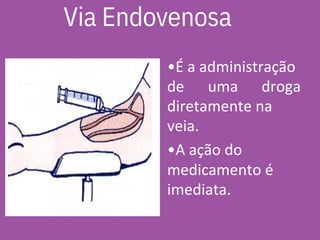•É a administração
de uma droga
diretamente na
veia.
•A ação do
medicamento é
imediata.
Via Endovenosa
 
