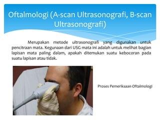 Oftalmologi (A-scan Ultrasonografi, B-scan
Ultrasonografi)
Merupakan metode ultrasonografi yang digunakan untuk
pencitraan mata. Kegunaan dari USG mata ini adalah untuk melihat bagian
lapisan mata paling dalam, apakah ditemukan suatu kebocoran pada
suatu lapisan atau tidak.
Proses Pemeriksaan Oftalmologi
 