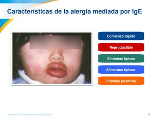 6Información confidencial y reservada de MJN
Características de la alergia mediada por IgE
Comienzo rápido
Reproductible
Síntomas típicos
Alimentos típicos 
Pruebas positivas
 