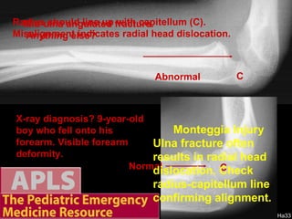 Apls Pediatric Emergency Radiology 1 | PPT